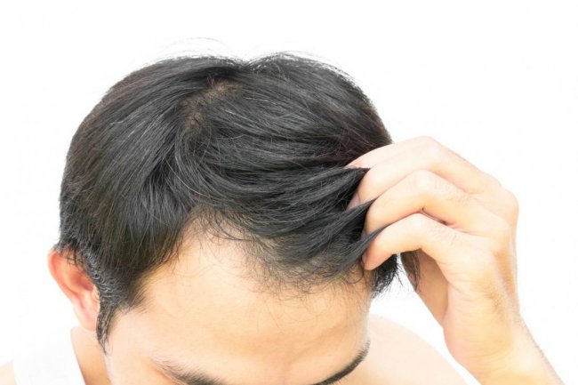 Tea Tree and Peppermint Essential Oil Blend for Hair Growth